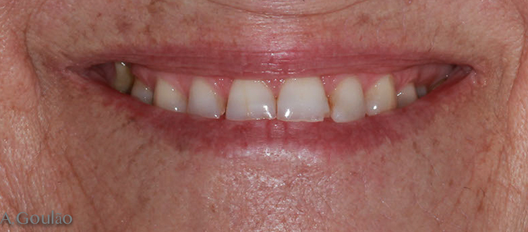 Foto inicial - Sorriso.jpg