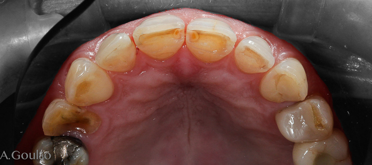 Palatino inicial.jpg