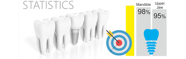 taxa de sucesso de implantes