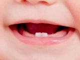 O aparecimento dos dentes do bebé causa febre?