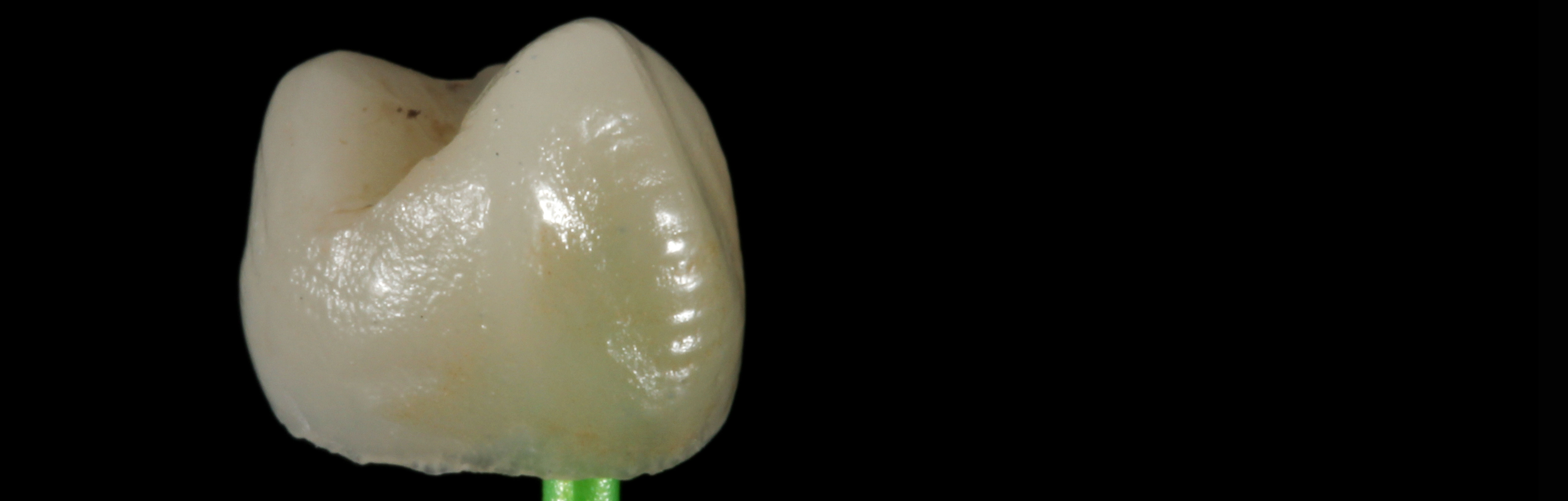 Coroas De Ceramica Pr tese Fixa Dentarmed CMD